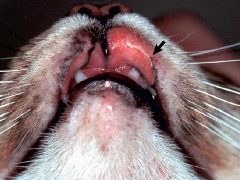 Виды и типы гранулем Разновидности болезни