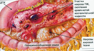 Как определить панкреатит у собак - признаки