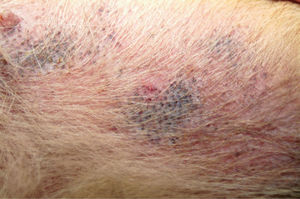 Шелушение кожи