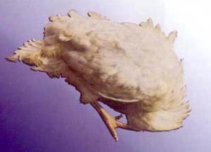 Степени заболевания