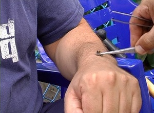 Описание способов лечения спины, остеохондроза и суставов пчёлами